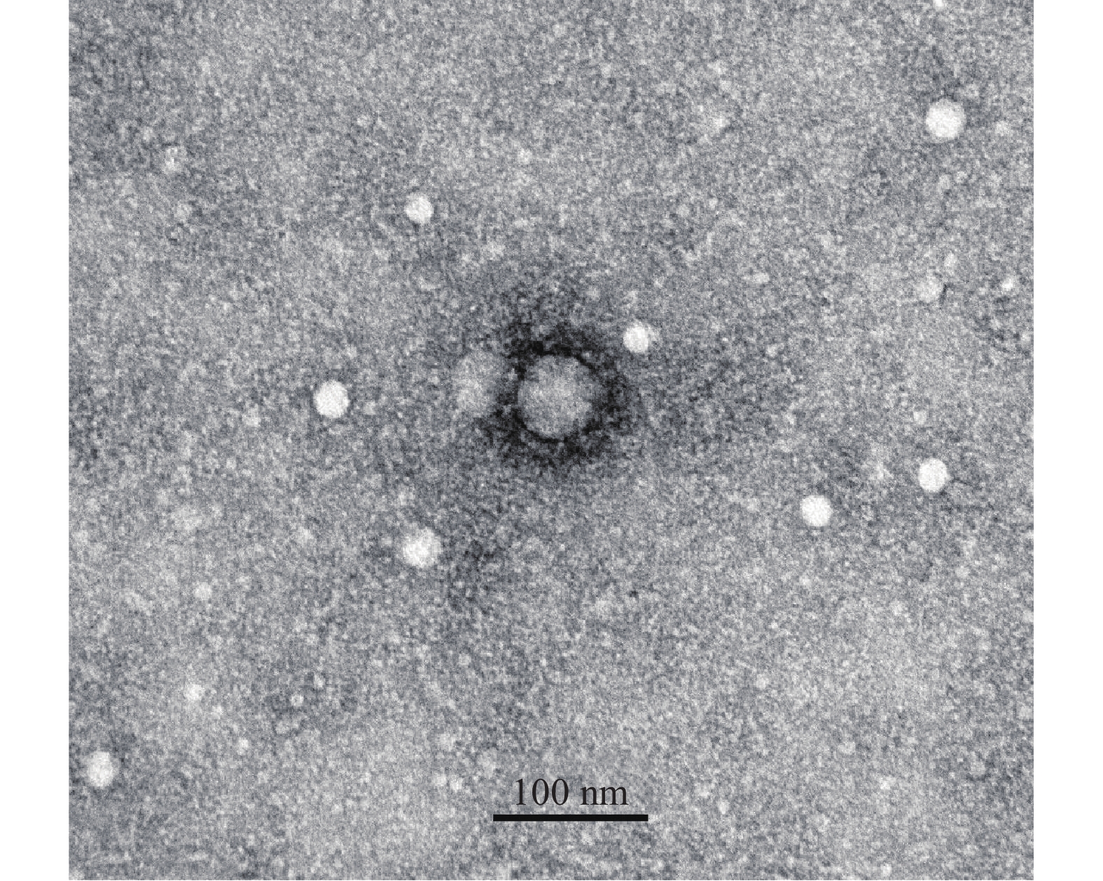 Coronavirus Disease 2019 (COVID-19)