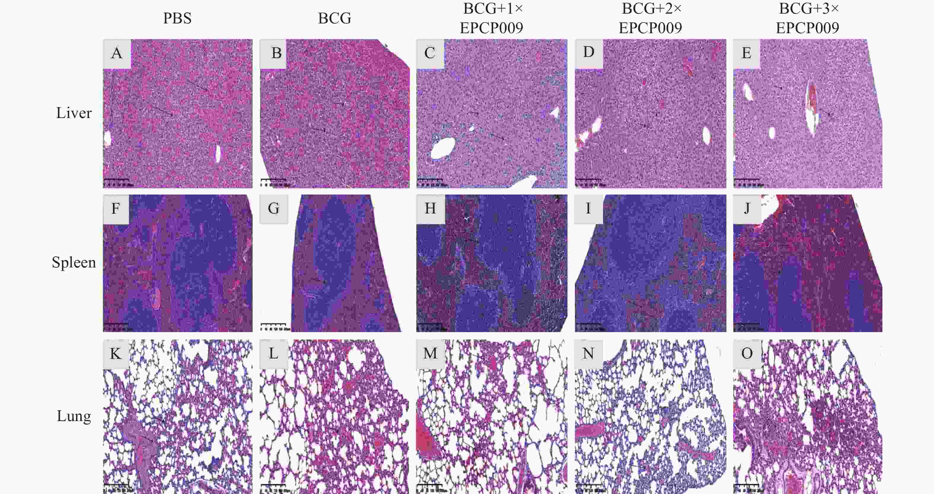 Protective Effect and Immune Mechanism of EPCP009 Booster